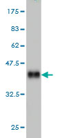 1 - PHOX2A Antibody (monoclonal) (M01) AT3303a