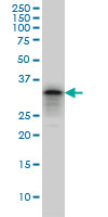 1 - PHOX2A Antibody (monoclonal) (M01) AT3303a