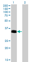 1 - PHOX2A Antibody (monoclonal) (M01) AT3303a
