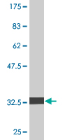 1 - PIGS Antibody (monoclonal) (M02) AT3308a