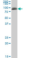 1 - PIGS Antibody (monoclonal) (M02) AT3308a