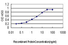 10 - PITX1 Antibody (monoclonal) (M01) AT3319a
