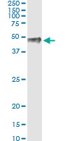5 - PITX1 Antibody (monoclonal) (M01) AT3319a