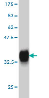 1 - PITX1 Antibody (monoclonal) (M01) AT3319a