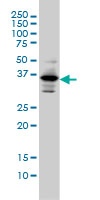 1 - PITX1 Antibody (monoclonal) (M01) AT3319a