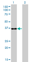 1 - PITX1 Antibody (monoclonal) (M01) AT3319a