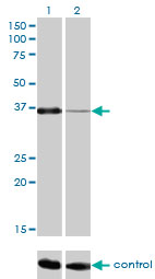 1 - PITX1 Antibody (monoclonal) (M01) AT3319a