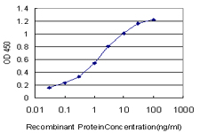 10 - PITX1 Antibody (monoclonal) (M02) AT3320a