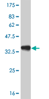 1 - PITX1 Antibody (monoclonal) (M02) AT3320a