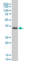 1 - PITX1 Antibody (monoclonal) (M02) AT3320a