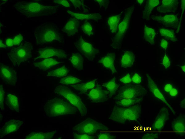 3 - PKNOX2 Antibody (monoclonal) (M01) AT3323a