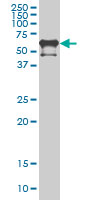 1 - PKNOX2 Antibody (monoclonal) (M01) AT3323a