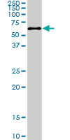 1 - PKNOX2 Antibody (monoclonal) (M01) AT3323a