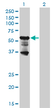 1 - PKNOX2 Antibody (monoclonal) (M01) AT3323a