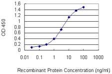 10 - PKNOX2 Antibody (monoclonal) (M01) AT3323a