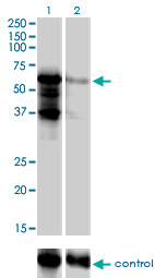 1 - PKNOX2 Antibody (monoclonal) (M01) AT3323a