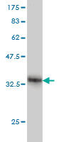 1 - PLCL2 Antibody (monoclonal) (M01) AT3336a