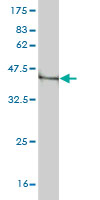 1 - PLEC1 Antibody (monoclonal) (M02) AT3338a