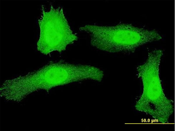 3 - PLEKHG5 Antibody (monoclonal) (M01) AT3341a
