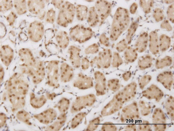 2 - PLEKHG5 Antibody (monoclonal) (M01) AT3341a