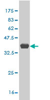 1 - PLEKHG5 Antibody (monoclonal) (M01) AT3341a