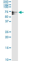 5 - PLK1 Antibody (monoclonal) (M01) AT3344a