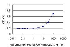10 - PMS2 Antibody (monoclonal) (M01) AT3358a