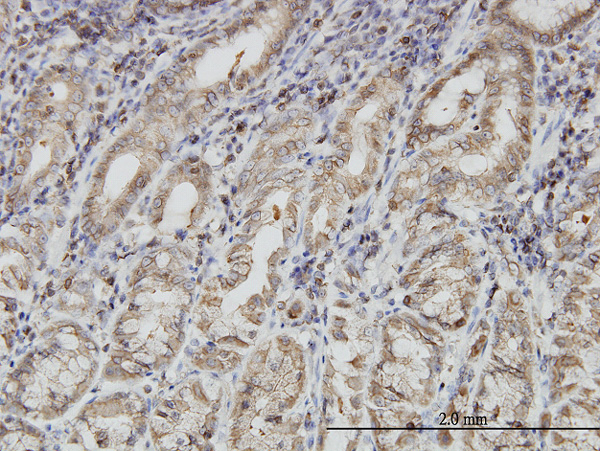 2 - PNMA1 Antibody (monoclonal) (M01) AT3360a