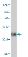 1 - PNMA1 Antibody (monoclonal) (M01) AT3360a