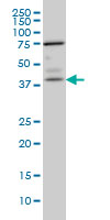 1 - PNMA1 Antibody (monoclonal) (M01) AT3360a