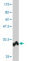 1 - POLD4 Antibody (monoclonal) (M10) AT3368a