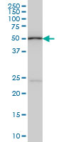 1 - POLE2 Antibody (monoclonal) (M01) AT3369a