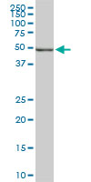 1 - POLE2 Antibody (monoclonal) (M01) AT3369a