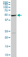 1 - POLE2 Antibody (monoclonal) (M01) AT3369a