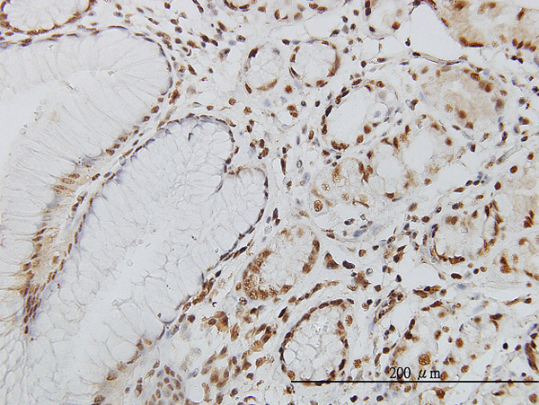 2 - POLK Antibody (monoclonal) (M01) AT3371a