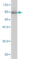 1 - POLK Antibody (monoclonal) (M01) AT3371a
