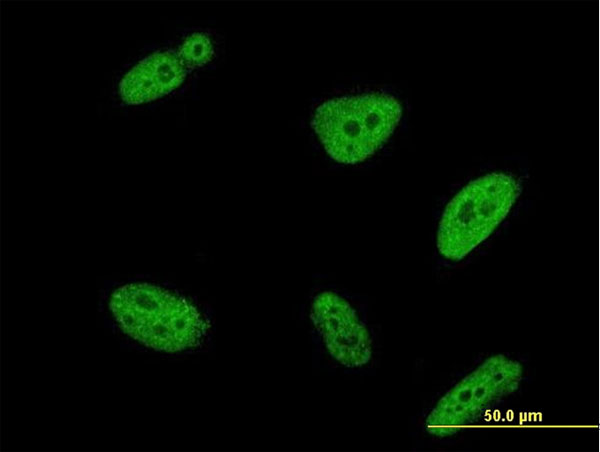 3 - POLR3K Antibody (monoclonal) (M01) AT3379a