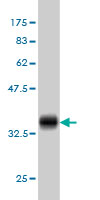 1 - POLR3K Antibody (monoclonal) (M01) AT3379a