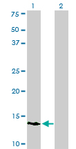 1 - POLR3K Antibody (monoclonal) (M01) AT3379a