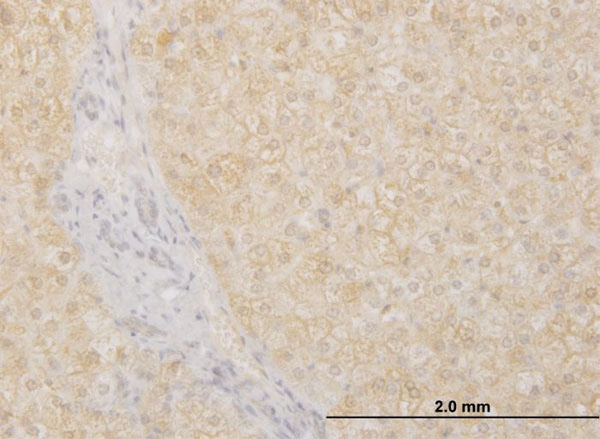 2 - POMGNT1 Antibody (monoclonal) (M07) AT3382a