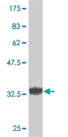 1 - POMGNT1 Antibody (monoclonal) (M07) AT3382a