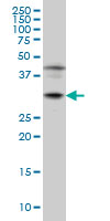 1 - POU6F1 Antibody (monoclonal) (M01) AT3387a