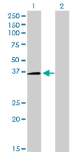 1 - POU6F1 Antibody (monoclonal) (M01) AT3387a