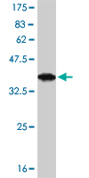 1 - POU6F1 Antibody (monoclonal) (M02) AT3388a