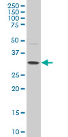 1 - POU6F1 Antibody (monoclonal) (M02) AT3388a