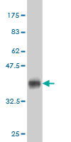 1 - pp9099 Antibody (monoclonal) (M03) AT3390a