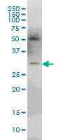 1 - pp9099 Antibody (monoclonal) (M03) AT3390a