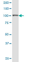 1 - PPFIBP2 Antibody (monoclonal) (M02) AT3399a