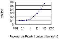 10 - PPP1R2P3 Antibody (monoclonal) (M01) AT3410a