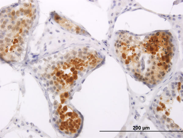 2 - PPP1R2P3 Antibody (monoclonal) (M01) AT3410a